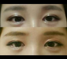ทำตาสองชั้นแบบกรีด เปิดหัวตา และเปิดหางตาแบบดูอัลค่ะ~~
