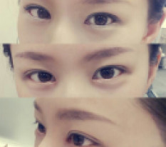 จากตาที่ดูเรียบๆ ตอนนี้มีชั้นตาสวยแล้วค่ะ
