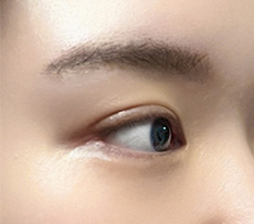 Saying goodbye to fierce-looking eyes