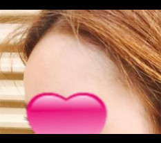 หน้าผากของฉันนูนกลมสวยแล้วค่ะ!