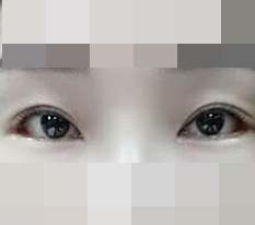 รีวิวเปิดหางตา+เปิดตาล่าง