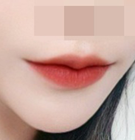 ริมฝีปาก chu~ ♥ สวยขึ้นมากไหม?