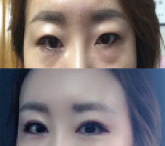 ชอบการแก้ศัลยกรรมมาก เลยมาเขียนรีวิวค่ะ ฮ่าๆ