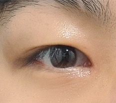 หลังเปิดหัวตาพลาด..