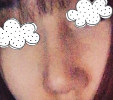 ทำจมูกแล้วเปลี่ยนภาพลักษณ์ไปเลย '-'♥