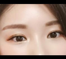 มารีวิวผ่าตัดตาสักหน่อยค่ะ^^