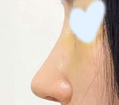 รู้สึกว่าตัดสินใจถูกและรู้สึกโล่งใจมากเลย