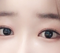 ตาสวยขึ้นมากๆ เลยค่ะ~^^