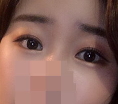 ฉันว่ามีตาสองชั้นแล้วไม่ทำตานี่เสียโอกาสจริงๆ ฮ่าๆ (รีวิวเปิดหางตาคู่+เปิดหัวตา)