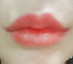 มุมปาก lol