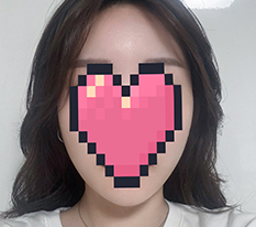 หน้าไข่♥