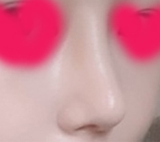 คนรอบตัวเห็นจมูกฉันแล้วฮือฮากันใหญ่เลยค่ะ lol