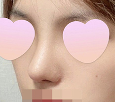 รู้สึกว่าความพึงพอใจที่ทำจมูกสูงมากจริงๆ ><