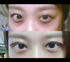 ทำตาสองชั้นแบบเย็บจุดมาค่ะ @_@