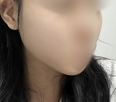 หน้าดูเรียวขึ้นแล้วค่ะ!!