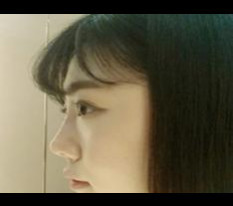 ฟิลเลอร์จมูกปังมาก