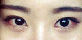 From Monolids to Pretty Eyes!