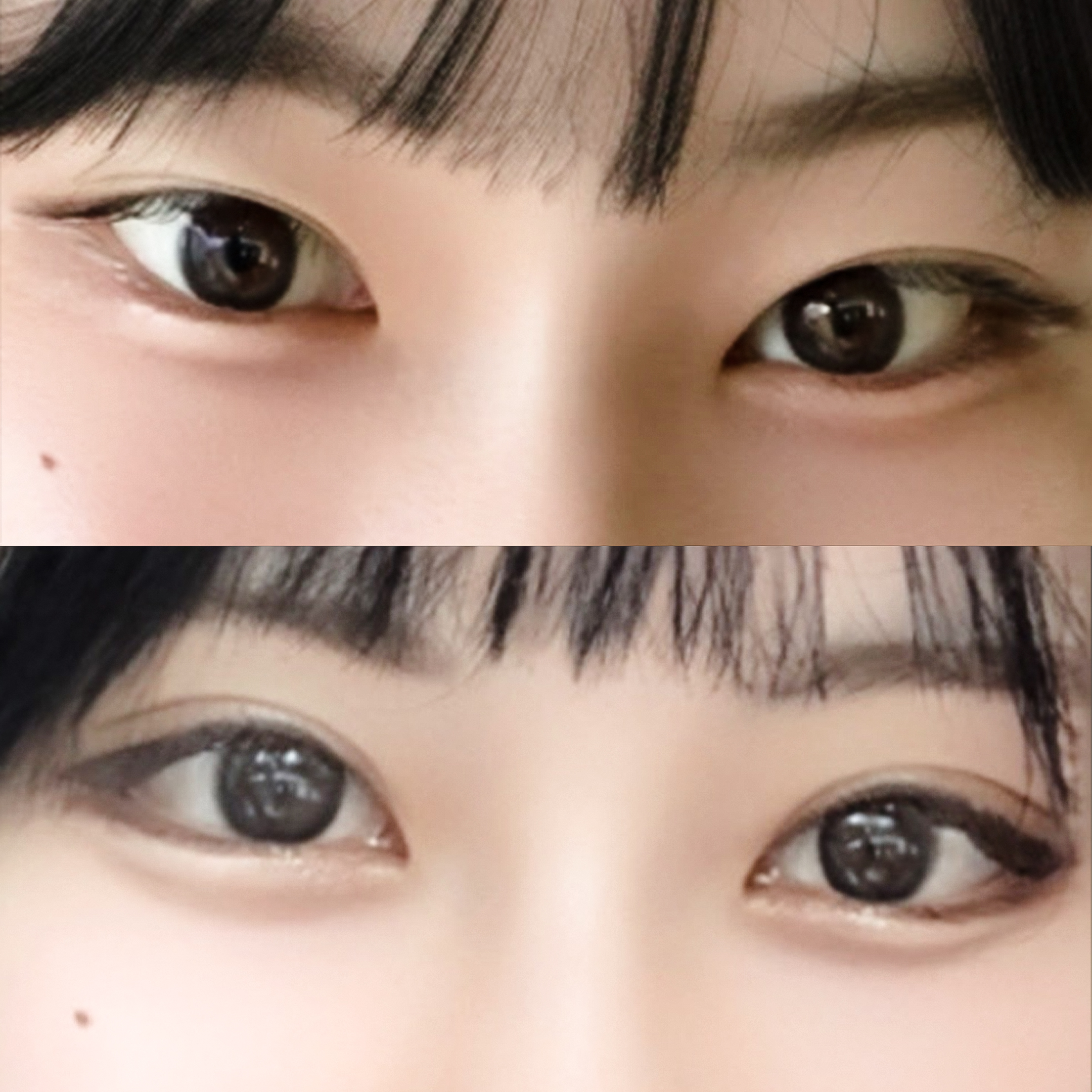 แก้ตาพร้อมเปิดมุมตาคู่ ได้ดวงตาที่ดูอ่อนโยนขึ้น