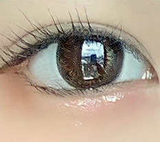 คนที่กำลังลังเลเรื่องผ่าตัดหางตาต้องดูนี่เลย!
