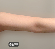 หมดเครียดเรื่องต้นแขนแล้วค่ะ ฮ่าๆ