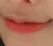 มุมปากเป็นยังไงบ้าง?