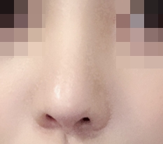 ปลายจมูกแหลมที่เคยมีตอนนี้นุ่มนวลขึ้นแล้ว!