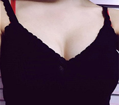 หน้าอกที่เคยแบนมีวอลลุ่มสุดยอด...!! แถมธรรมชาติมากๆ ด้วยค่ะ^^