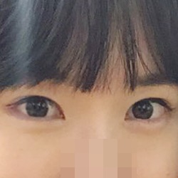 ขอบคุณคุณหมอฮวังโฮค่ะ