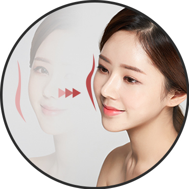 ไลน์ — แนวโหนกแก้มด้านข้าง 45 องศา(Ogee Curve)
