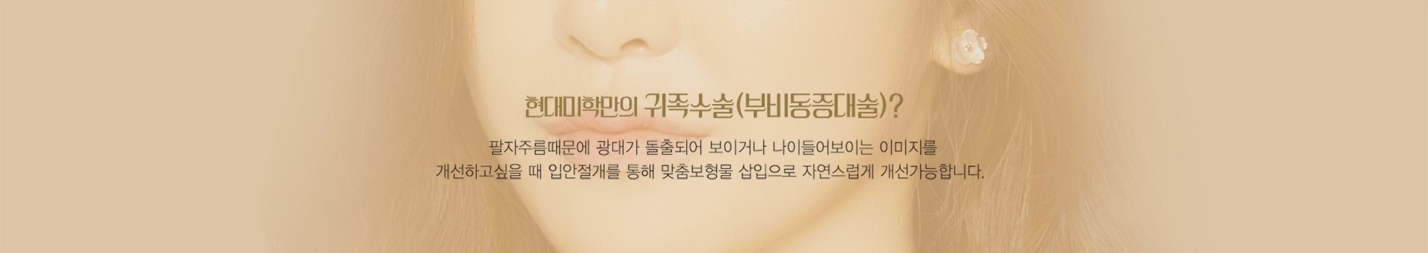 การผ่าตัดเสริมร่องแก้มเฉพาะของ H-Mihak (การเสริมบริเวณข้างจมูก)? — คำอธิบายบนใบหน้านางแบบ