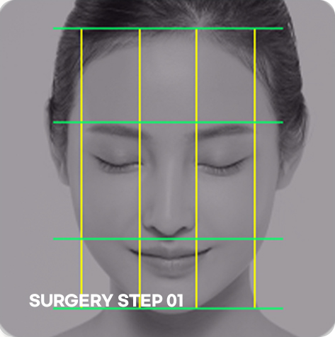 ภาพขั้นตอนแก้ไขรูปตาแบบกรีด STEP 01 การวินิจฉัยสัดส่วนรูปหน้า