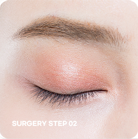 ภาพขั้นตอนแก้ไขรูปตาแบบกรีด STEP 02 การออกแบบตำแหน่งและไลน์