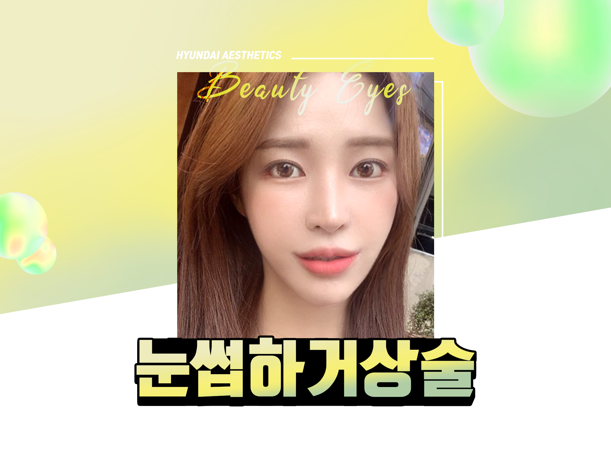 การผ่าตัดยกคิ้วของ H-Mihak — HYUNDAI AESTHETICS Beauty Eyes, ภาพนางแบบการผ่าตัดยกคิ้วใต้คิ้ว