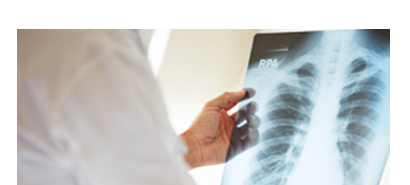 การตรวจ X-Ray