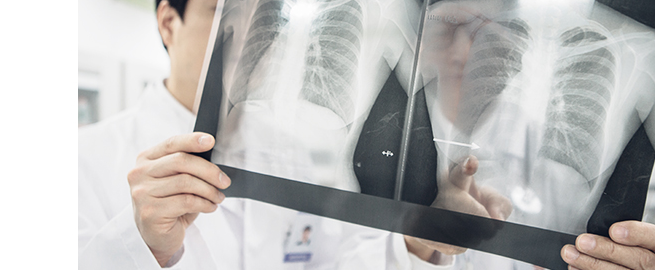 การเตรียมการดมยาสลบอย่างปลอดภัยผ่านการตรวจก่อนผ่าตัด (X-Ray)