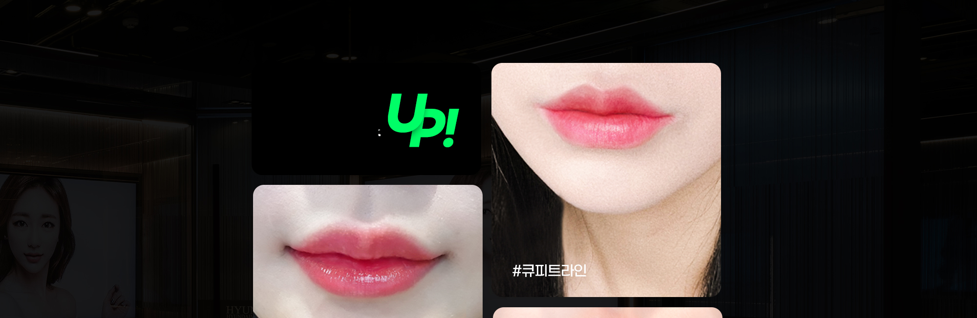 ภาพริมฝีปากก่อนและหลังศัลยกรรมริมฝีปาก Cupid Line