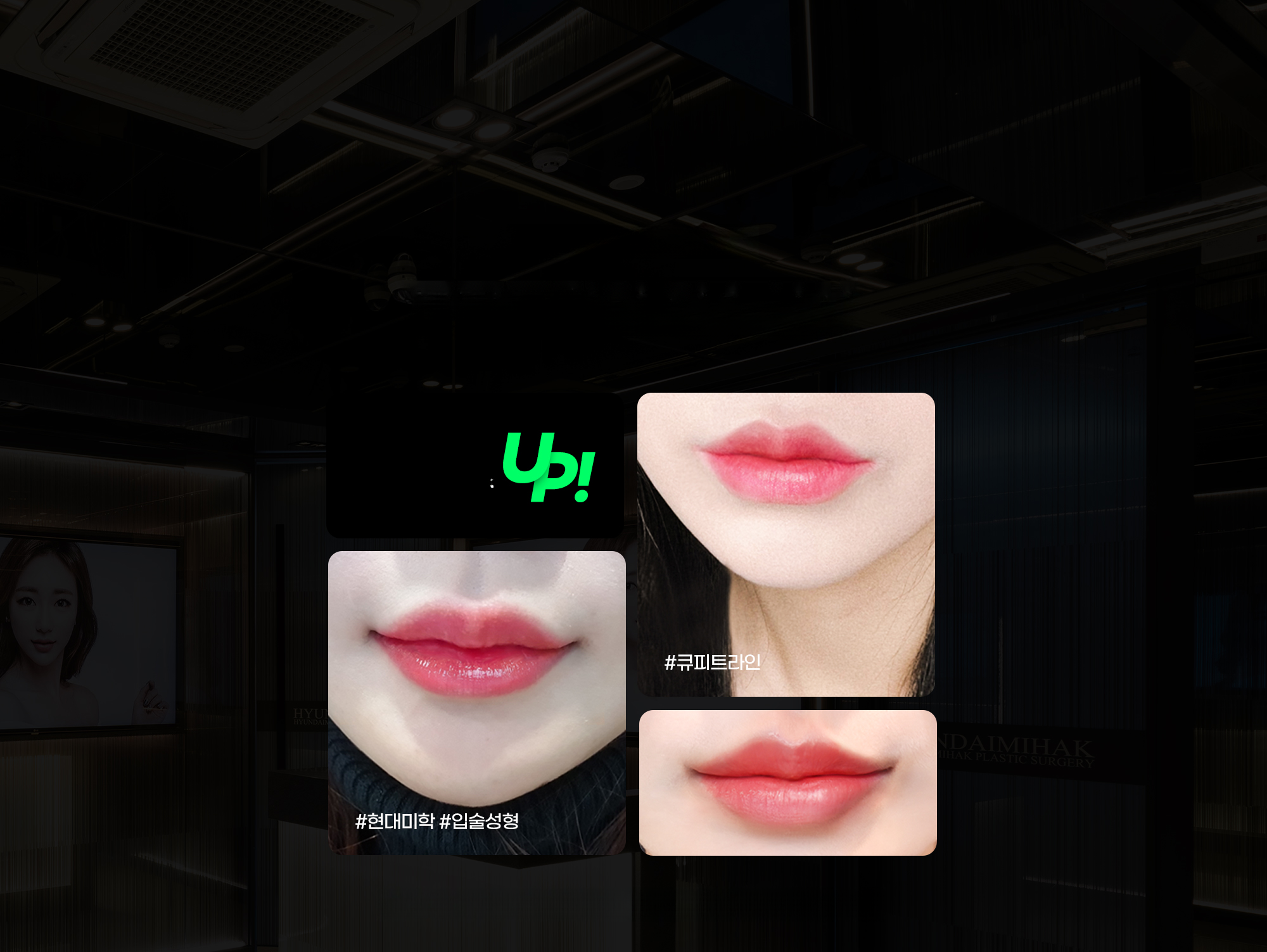 ภาพริมฝีปากก่อนและหลังศัลยกรรมริมฝีปาก Cupid Line