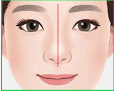 ภาพประกอบรูปทรงจมูกปกติ