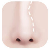 ภาพประกอบจมูกที่สันจมูกเบี้ยว