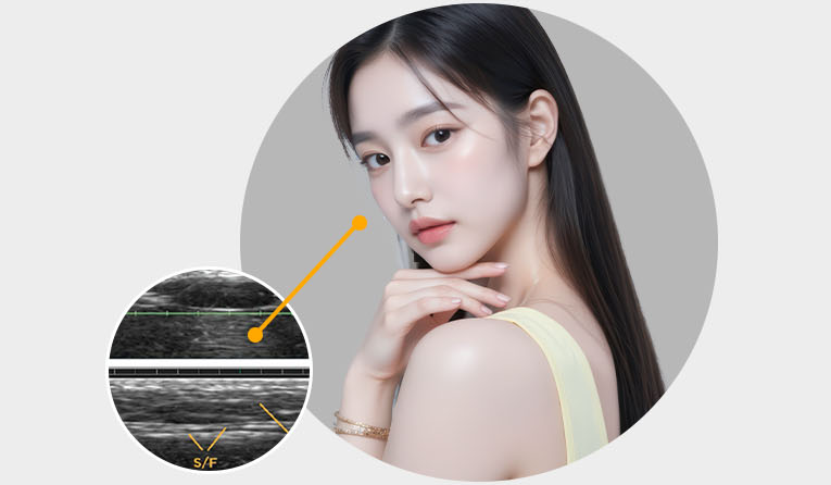 ดีไซน์การลิฟติ้งโดยคำนึงถึงสมดุลทั่วทั้งใบหน้า — ตรวจสอบจุดเริ่มต้นด้วยภาพอัลตราซาวด์แบบเรียลไทม์